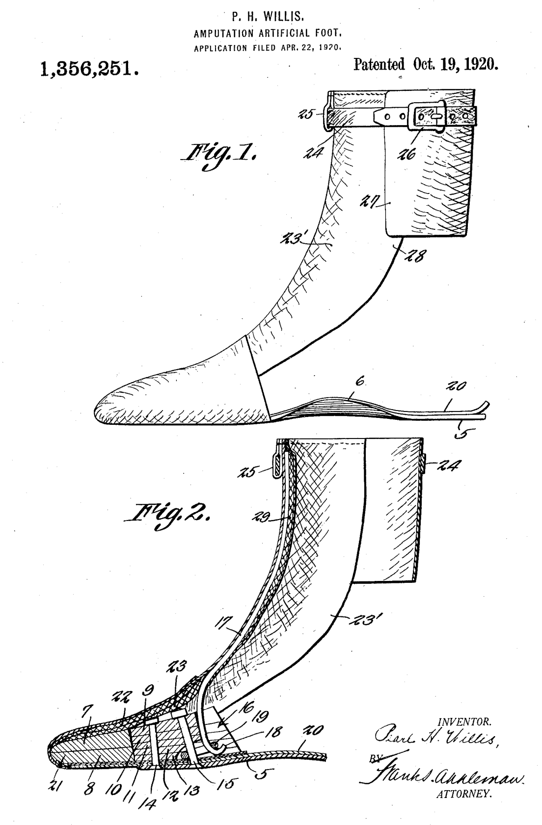 US1356251 patent drawing
